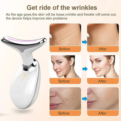 Skin care device with before and after effects on skin texture and appearance.